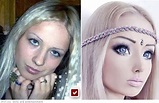 Valeria Lukyanowa - before and after plastic surgery