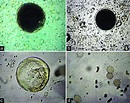 Cysts of Balantidium coli observed in fecal samples from pigs by ...