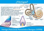 Vértigo Postural Paroxístico Benigno (VPPB)
