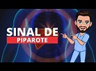 Sinal de Piparote - Ascite - YouTube