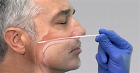 Test rápido COVID-19 Antígeno Nasofaríngeo (20 uds) | IES MEDICAL