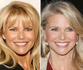 Christie Brinkley before and after plastic surgery 07 – Celebrity ...
