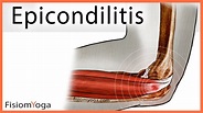 Epicondilitis – Fisiom