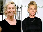 Trudie Styler Before And After Plastic Surgery