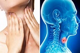 Cáncer de garganta: síntomas, tratamientos, diagnóstico y más