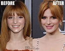 Bella Thorne Plastic Surgery Secrets! Before And After