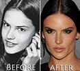 Alessandra Ambrosio before and after surgery | Alessandra ambrosio ...