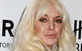 Depois do álcool e das drogas! Lindsay Lohan tem o vício do botox e das ...