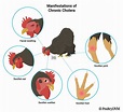 Fowl cholera in Chickens