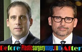 Steve Carell Plastic Surgery: Hair Transplant | Plastic Surgery Magazine