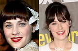 Zooey Deschanel Plastic Surgery Before and After Photos - Latest ...