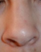 File:Human-nose.jpg - Wikipedia