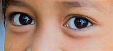 Warum sind schwarze Augen bei Menschen selten? | Referenz