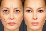 The 10 Most Common Plastic Surgery Procedures