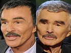 Burt Reynolds Plastic Surgery Before And After