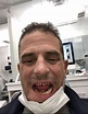Hunter Biden photos: Shock pics show destroyed teeth before getting ...