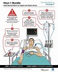Sepsis and Septic Shock Definitions - Nurse Your Own Way