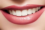 Benefits of having white teeth - Platinum Dental Surgery