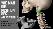 Atlaswirbel : Atlaswirbel Ausgerenkt Oder Verschoben Orthopadie ...