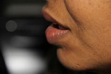 How to help a busted lip? - Wound Care Society
