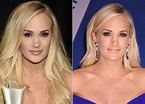 Carrie Underwood Plastic Surgery: Did She Get Lip Surgery?