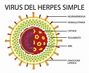 Herpes simple tipo 1: ¿qué es? Causas, síntomas y más