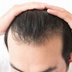 What is DHT? (Dihydrotestosterone) - Regrowth. Your Source Of Hair News