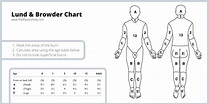 Fluid Resuscitation in Burns · Formulas, Indications & Fluids