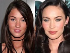 Megan Fox Before and After Plastic Surgery: A Tale of Evolution | ASEAN TV