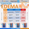 Medicina ENARM 😷 en Instagram: “CLASIFICACIÓN DEL EDEMA 🩺 Aprovecha HOY ...