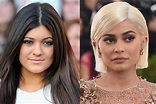 É triste saber a razão do preenchimento labial de Kylie Jenner | CLAUDIA