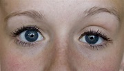Amblyopia - LASIK Eye Surgery Grand Junction | Cataracts Grand Junction ...