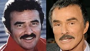 Burt Reynolds Facelift Plastic Surgery Before and After | Celebie