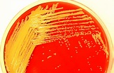 Medical Laboratory and Biomedical Science: Golden bacterium ...