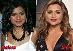 Mindy Kaling before and after plastic surgery | Celebrity plastic ...