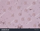 Protozoa Stool Entamoeba Coli Stock Photo 1043690329 | Shutterstock