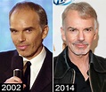 Bald Hollywood - 5 Actors That Have Had Hair Transplants - Chicago Hair ...