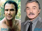 Burt Reynolds Plastic Surgery Before and After | | Plastic Surgery Magazine