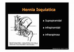 CLASE DE HERNIAS Y EVENTRACIONES DEL SEGUNDO CURSO DE CIRUGÍA DEL SER…