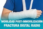 Impresionante Ídolo desenterrar fractura distal del radio Marcha mala ...