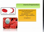Anemia drepanocitica en pediatria