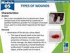 10-types-of-wounds3 – National Center for Sports Safety