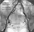 Pelvic Arterial Anatomy Angiogram - Human Anatomy