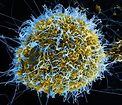 Fichier:Ebola Virus Particles (7).jpg — Wikipédia