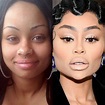 Black Chyna Plastic Surgery Has Dramatically Changed Her Face Much Like ...