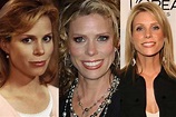 Cheryl Hines Plastic Surgery Before and After Pictures 2024