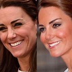 Kate Middleton: Clínica de estética usa foto de Kate Middleton para ...