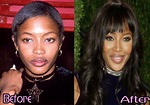 Naomi Campbell Plastic Surgery Before After Photos | Plastic surgery ...