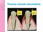 Trauma oclusal