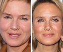 Renee Zellweger Before and After Transformation - Verge Campus